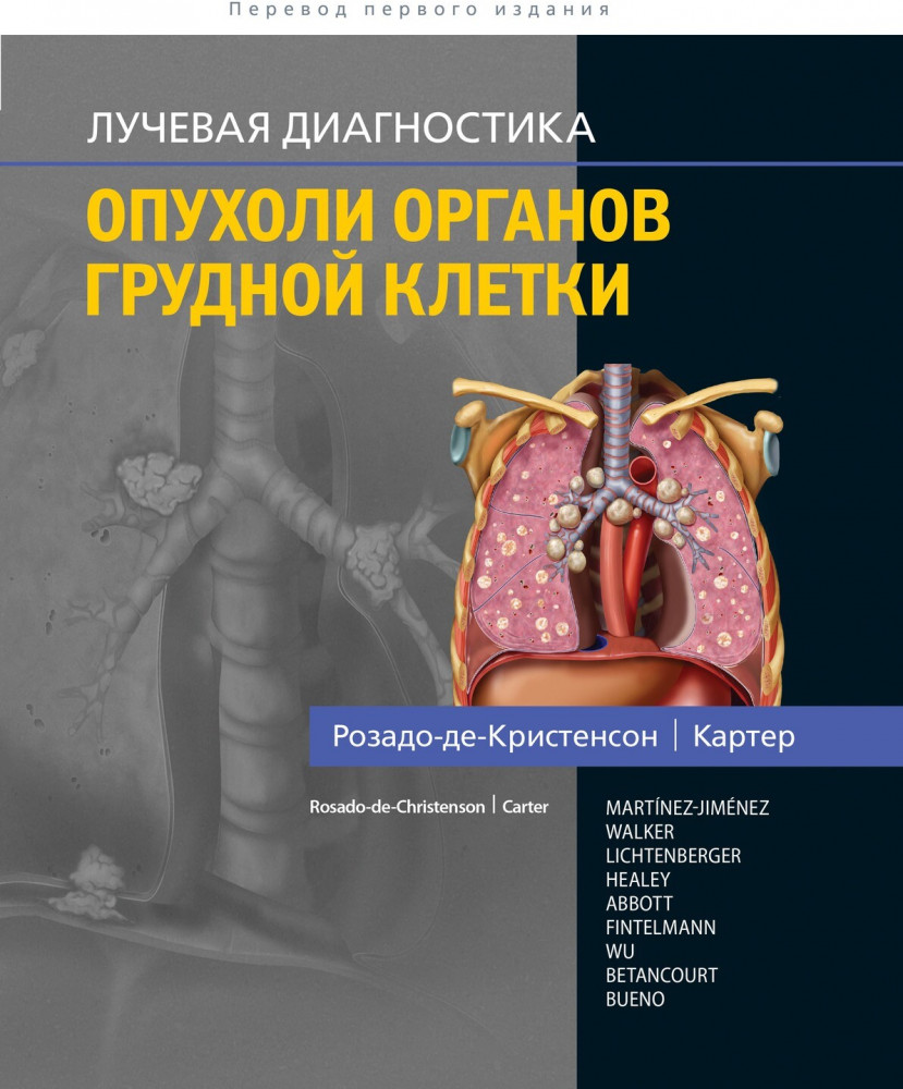 Лучевая диагностика. Опухоли органов грудной клетки