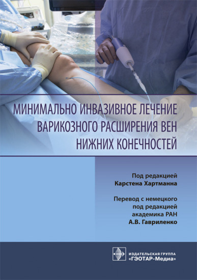 Минимально инвазивное лечение варикозного расширения вен