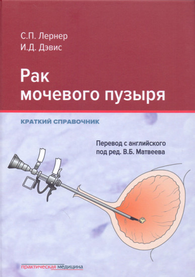 Рак мочевого пузыря. Краткий справочник