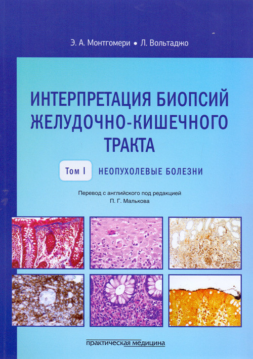 Интерпретация биопсий желудочно-кишечного тракта. Руководство. Том 1. Неопухолевые болезни