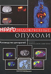 Нейроэндокринные опухоли. Руководство для врачей