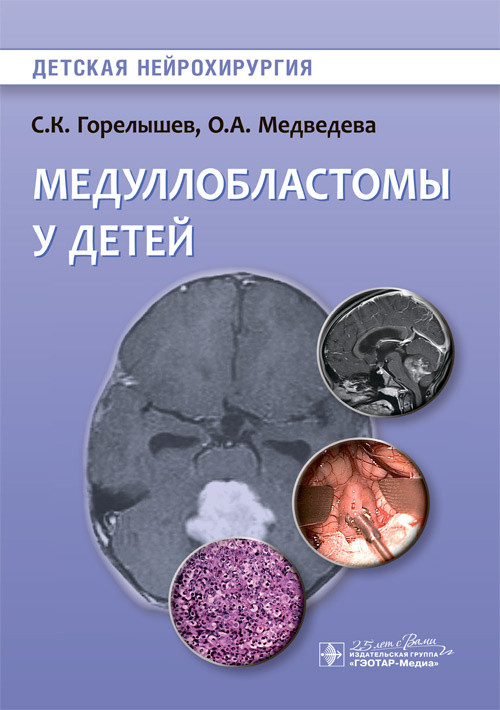 Медуллобластомы у детей | Детская нейрохирургия