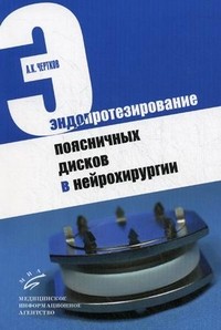 Эндопротезирование поясничных дисков в нейрохирургии