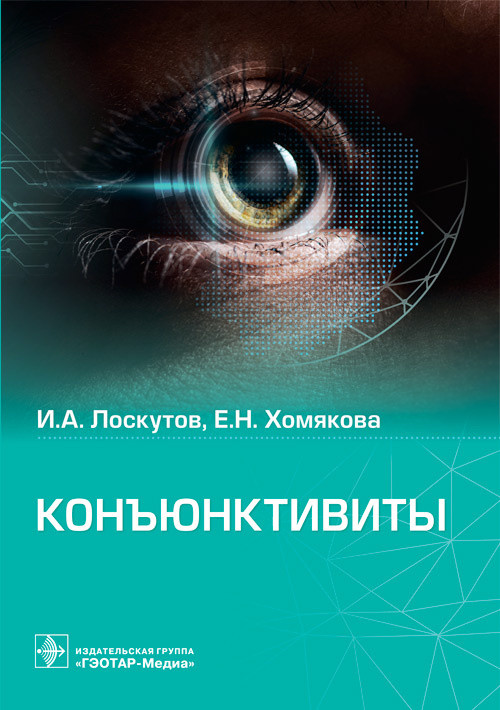 Конъюктивиты