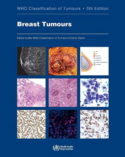 WHO Classification of Breast Tumours. 5th Edition
