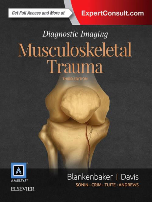 Musculoskeletal Trauma