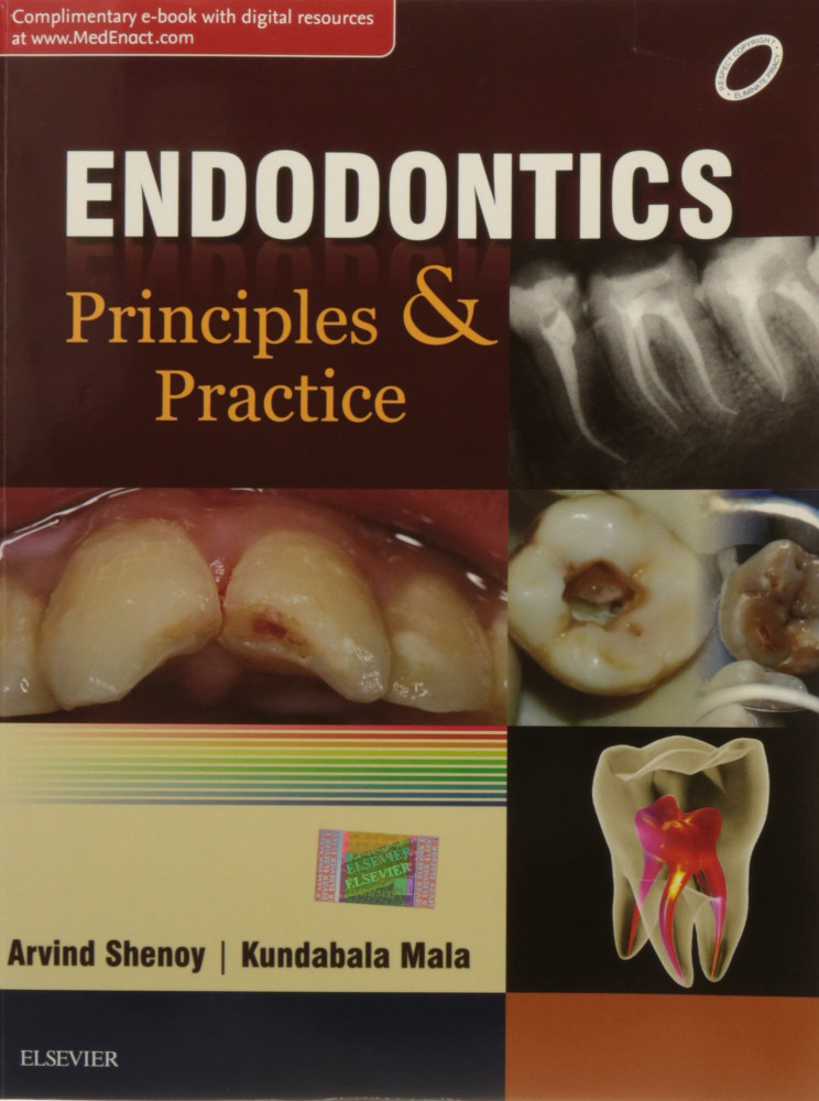 Endodontics. Principles and Practice