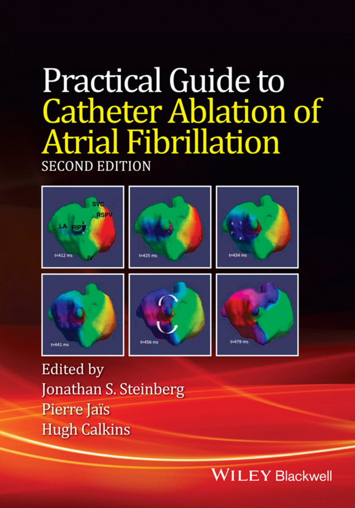 Practical Guide to Catheter Ablation of Atrial Fibrillation