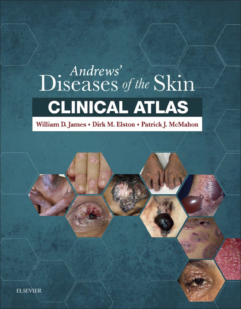 Andrews` Diseases of the Skin Clinical Atlas