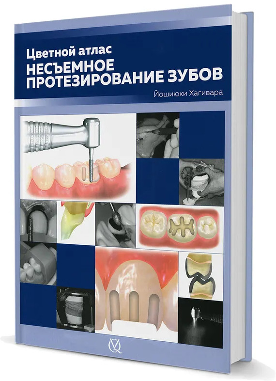 Несъемное протезирование зубов. Цветной атлас