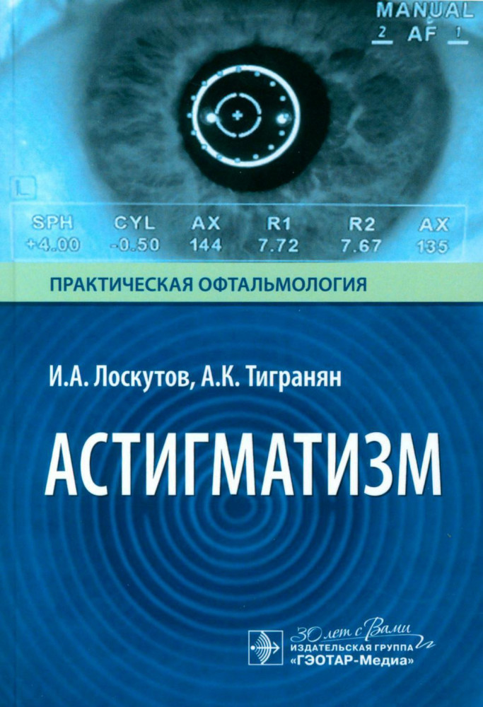 Астигматизм | Практическая офтальмология