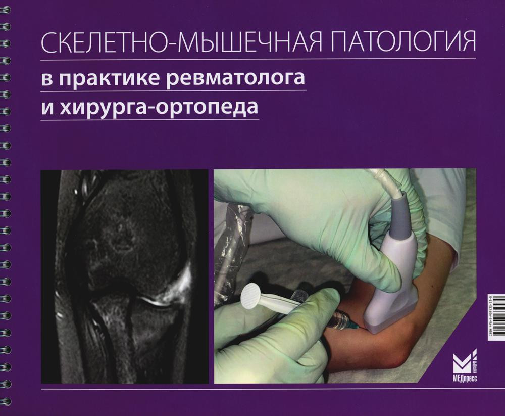 Скелетно-мышечная патология в практике ревматолога и хирурга-ортопеда. Краткое иллюстрированное руководство