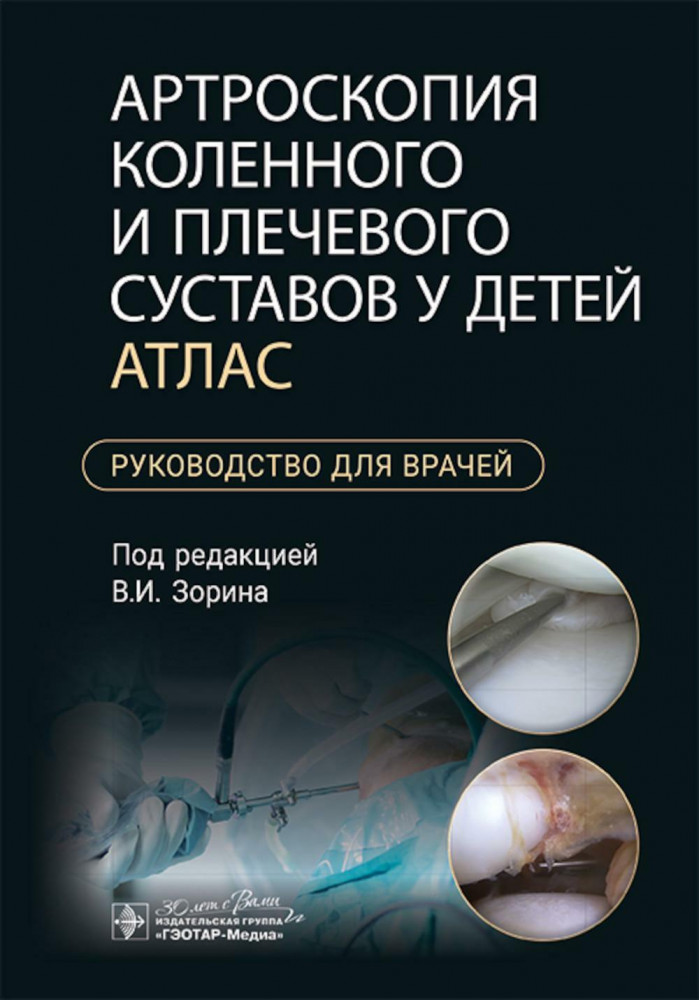 Артроскопия коленного и плечевого суставов у детей. Атлас: руководство для врачей | Руководство для врачей