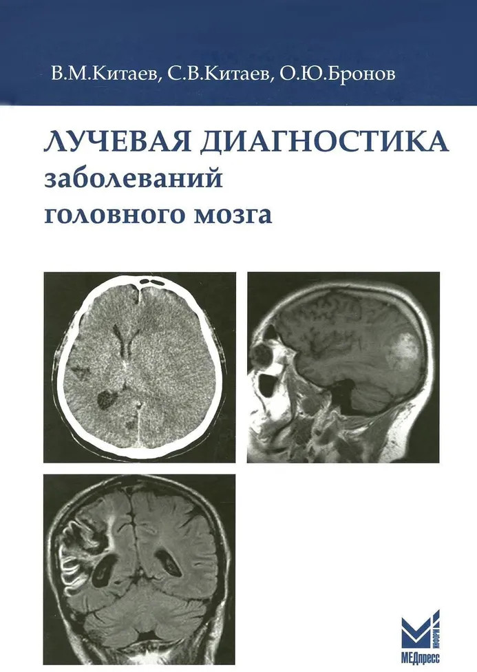 Лучевая диагностика заболеваний головного мозга