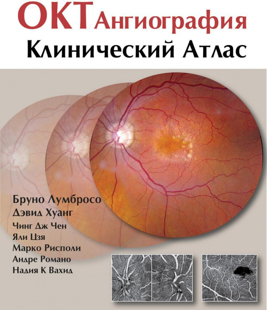ОКТ-ангиография. Клинический атлас