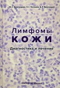Лимфомы кожи. Диагностика и лечение