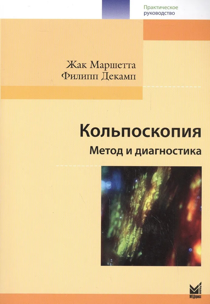 Кольпоскопия. Метод и диагностика