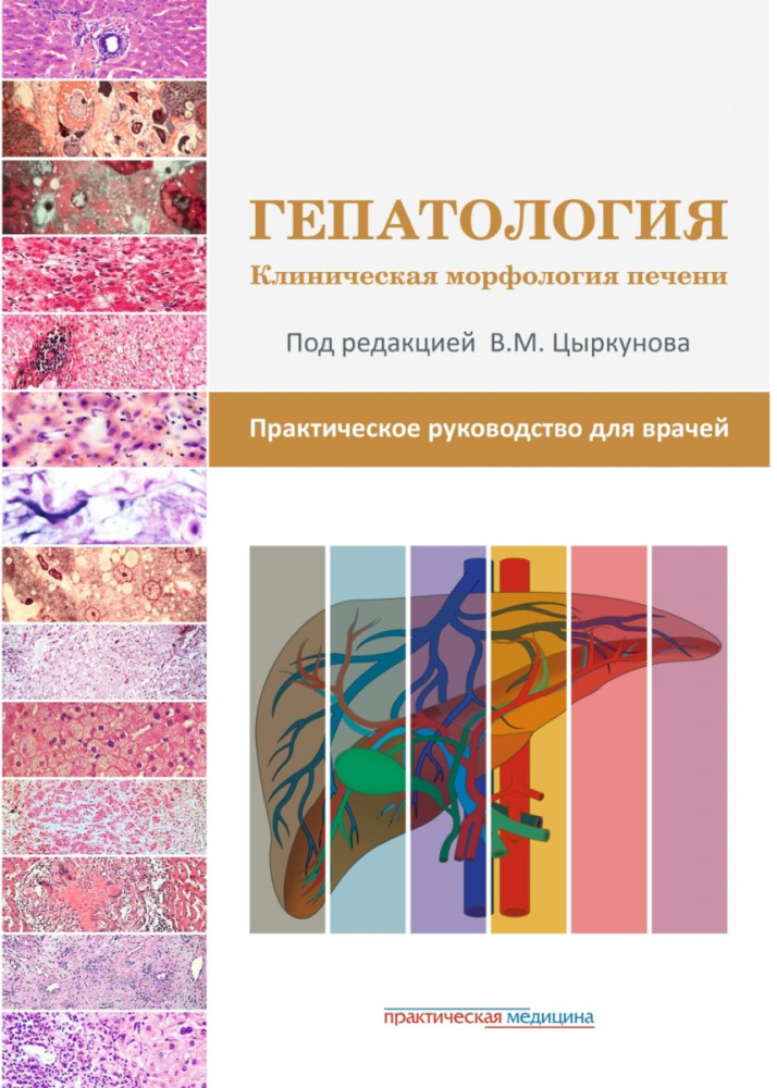 Гепатология. Клиническая морфология печени. Практическое руководство для врачей