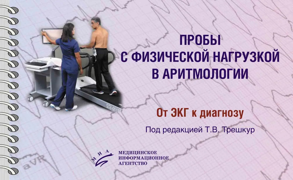 Пробы с физической нагрузкой в аритмологии