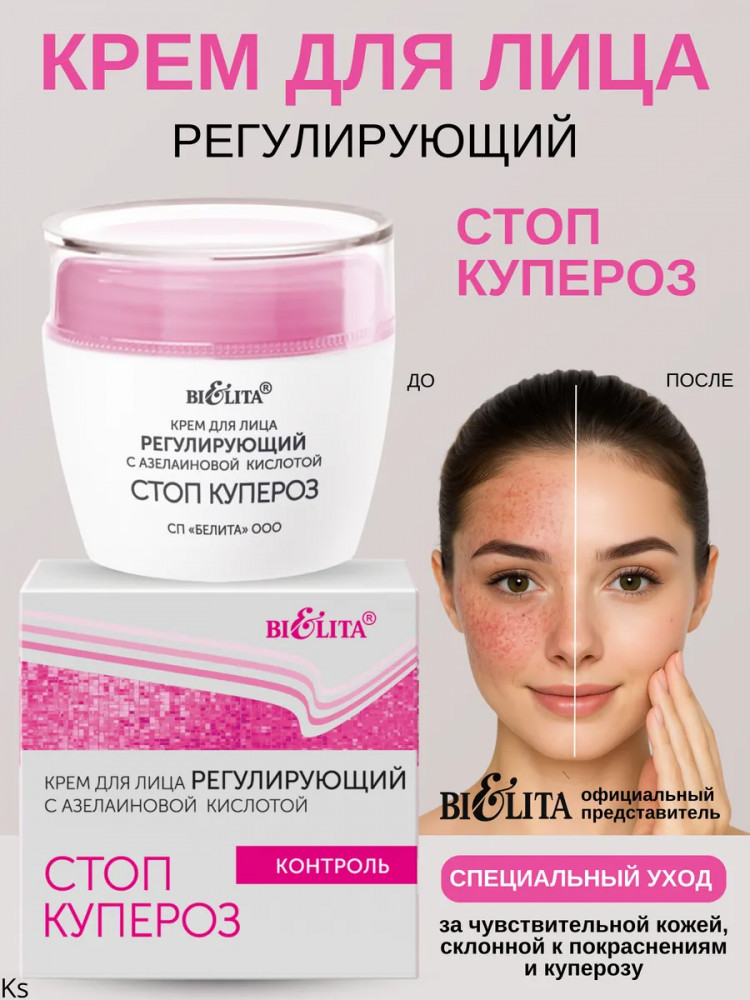Крем для лица регулирующий с азелаиновой кислотой | Стоп купероз | Bielita