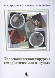 Эндоскопическая хирургия геморрагического инсульта