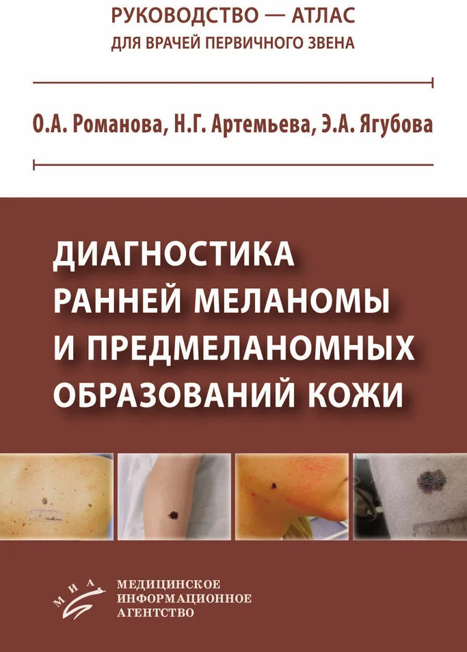 Диагностика ранней меланомы и предмеланомных образований кожи