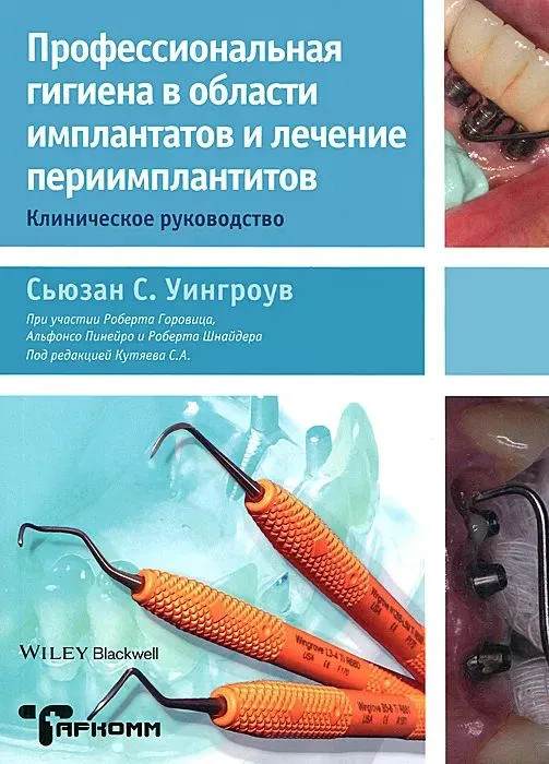 Профессиональная гигиена в области имплантатов и лечение периимплантитов