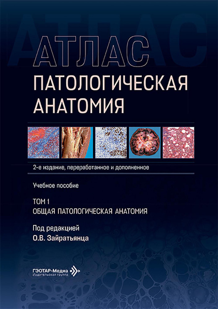 Патологическая анатомия. Атлас. Том 1. Общая патологическая анатомия