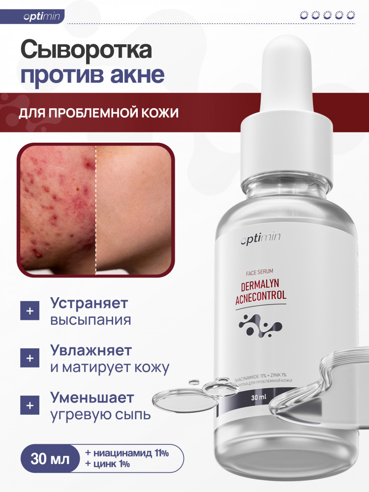 Сыворотка для лица против акне | Optimin