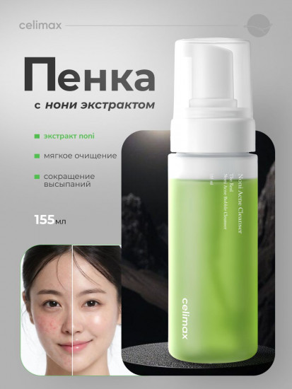 Кислородная пенка с экстрактом нони «The Real Noni Acne Bubble Cleanser»