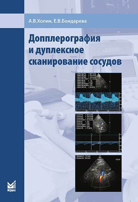 Допплерография и дуплексное сканирование сосудов