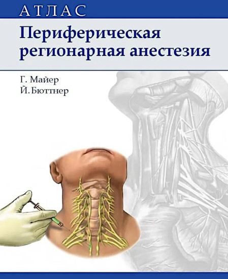 Периферическая регионарная анестезия