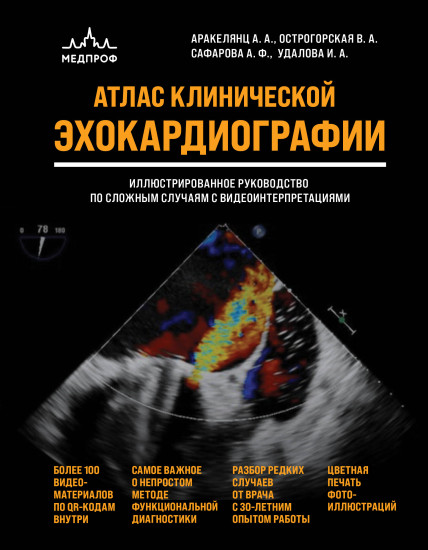 Атлас ЭхоКГ. Иллюстрированное руководство по сложным случаям с видеоинтерпретациями