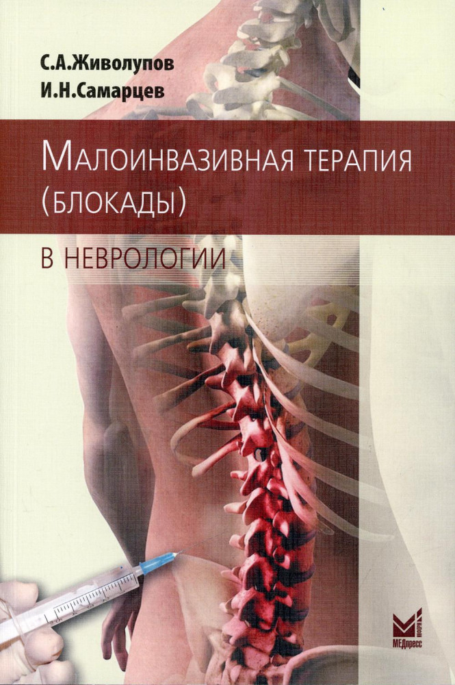 Малоинвазивная терапия (блокады) в неврологии