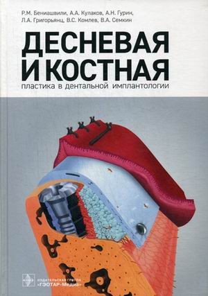 Десневая и костная пластика в дентальной имплантологии. Руководство