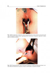 Атлас колопроктологических заболеваний - Фото 10