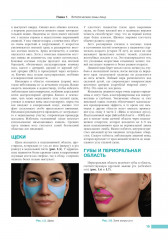 Анатомия лица в эстетической медицине - Фото 5