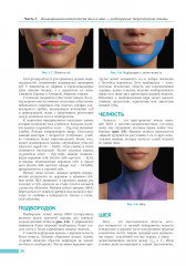 Анатомия лица в эстетической медицине - Фото 6