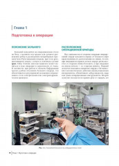 Атлас торакоскопических лобэктомий при злокачественных опухолях - Фото 2