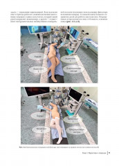 Атлас торакоскопических лобэктомий при злокачественных опухолях - Фото 3