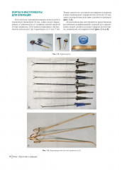 Атлас торакоскопических лобэктомий при злокачественных опухолях - Фото 4