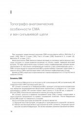 Микрохирургия сложных аневризм средних мозговых артерий: гигантских, фузиформных и частично тромбированных - Фото 4