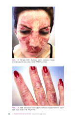 Ревматические болезни. Гистологический атлас - Фото 7