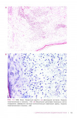 Ревматические болезни. Гистологический атлас - Фото 8