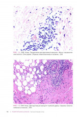 Ревматические болезни. Гистологический атлас - Фото 9