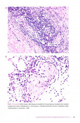 Ревматические болезни. Гистологический атлас - Фото 10