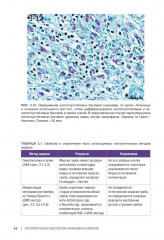 Гистологическая диагностика инвазивных микозов - Фото 6