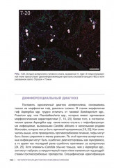 Гистологическая диагностика инвазивных микозов - Фото 10