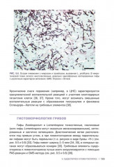 Гистологическая диагностика инвазивных микозов - Фото 11