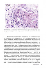 Гистологическая диагностика инвазивных микозов - Фото 12